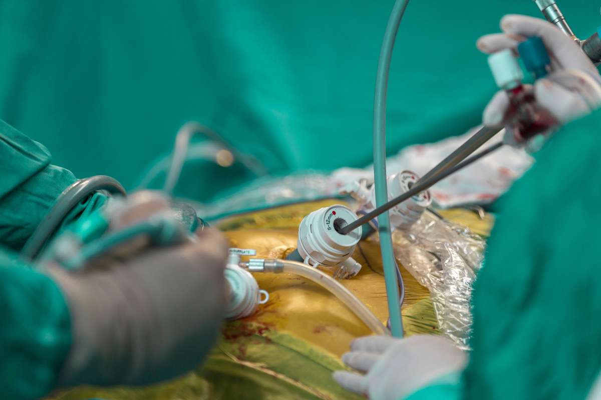Laparoscopic Hernial Repair